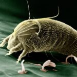 Are Tiny Mites on Your Face Keeping You Up at Night?
