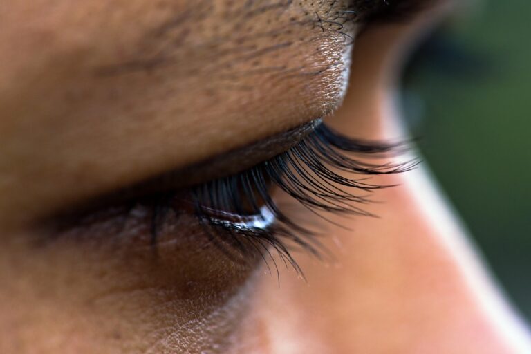 Macular Degeneration 101: What You Need to Know About This Common Eye Condition