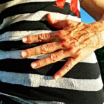 The Shocking Rise in Early-Onset Colorectal Cancer—What You Need to Know