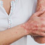 Kim Kardashian’s Skin Condition and the Signs You Should Watch For