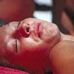 How to Treat a Sunburn at Home (Without Making it Worse)