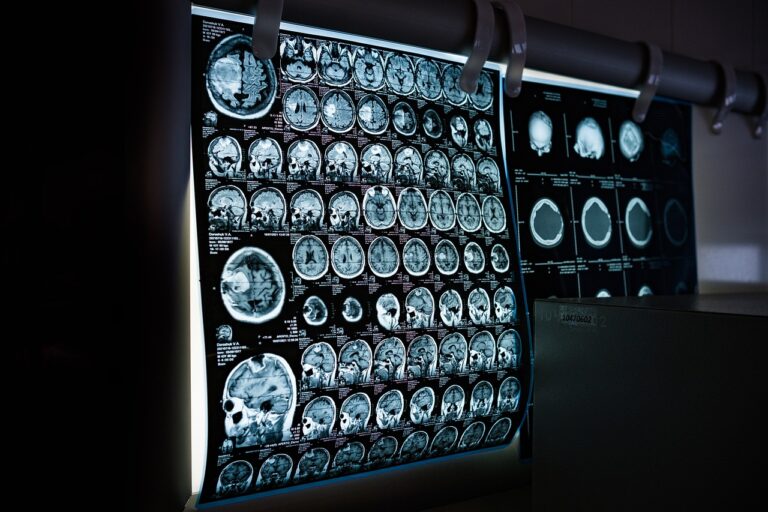 Is Your Brain Secretly Aging Too Fast? One Scan Could Reveal the Truth