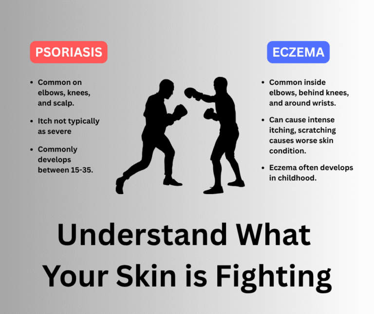 Understanding the Difference Between Psoriasis and Eczema
